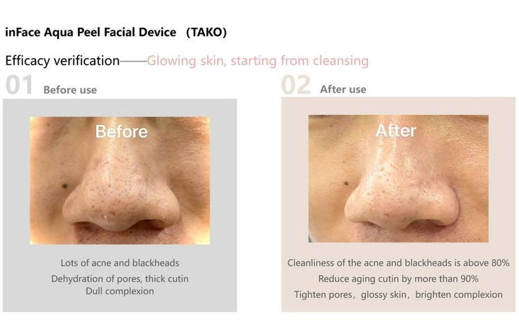 دستگاه پاک کننده منافذ صورت شیائومی Xiaomi Youpin InFace Aqua Peel Facial Pore Cleaner CF-02E